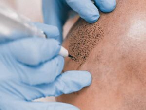 Tatuaggio per Testa Pelata -3